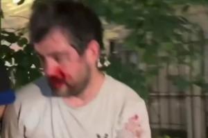 邓肯被击退退出刺籍，纽约暴徒围殴“邓肯”！满身鲜血脱衣保命